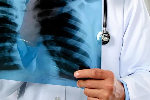 'Tüdőszűrés' cikk borítóképe